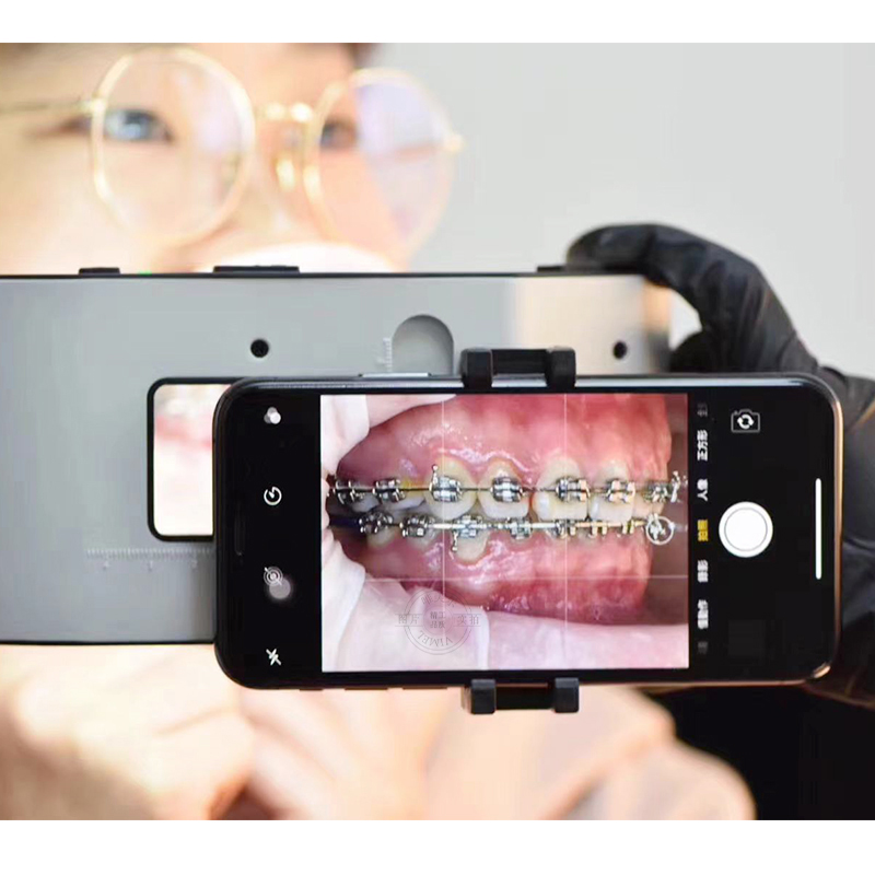 New Dental Flash Light  with H - Photography Equipment review and price