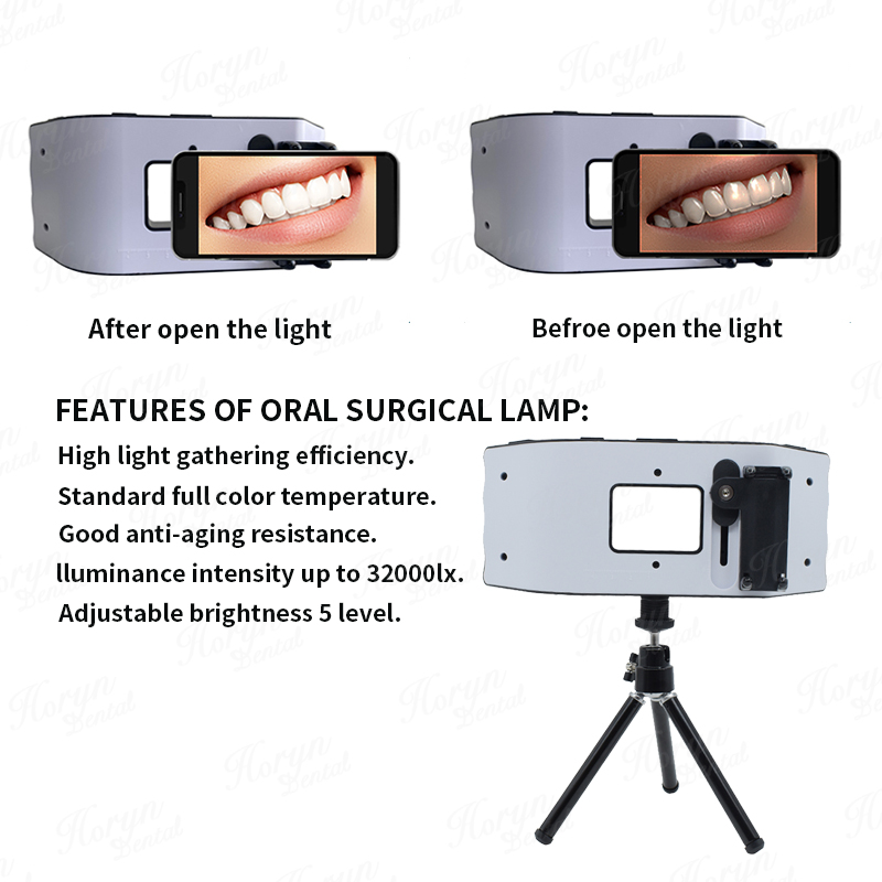 Dental Flash Light Photography - Photography Equipment review and price
